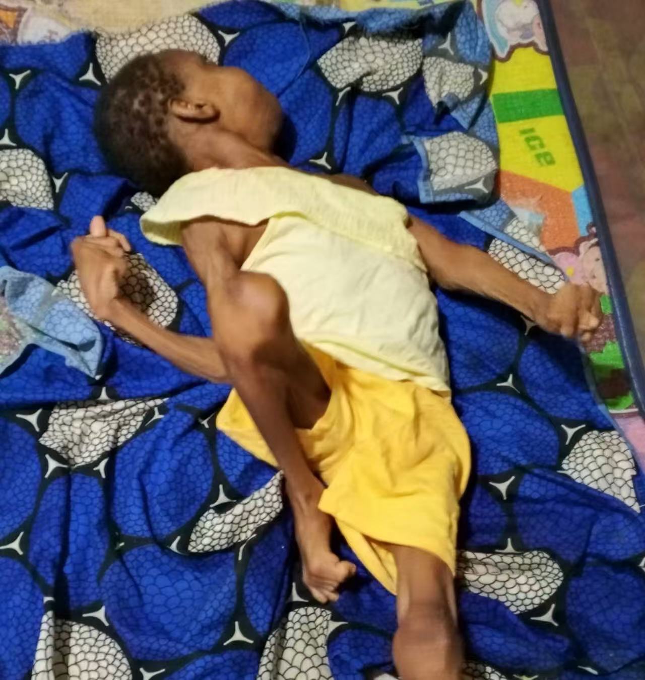 Help a Child Stand and Smile Again!