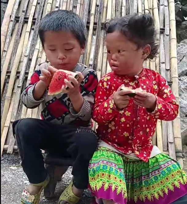 كاب باخ! Giúp đỡ trẻ bị bỏng sâu