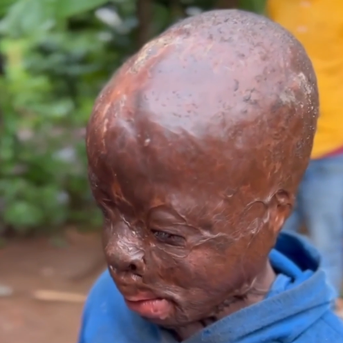 Restore Their Faces. Restore Their Hope.