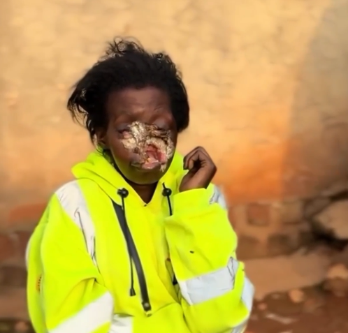 Save Her Face. Save Her Life.