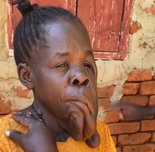 Ajude crianças com deficiência a aproveitarem uma vida plena!